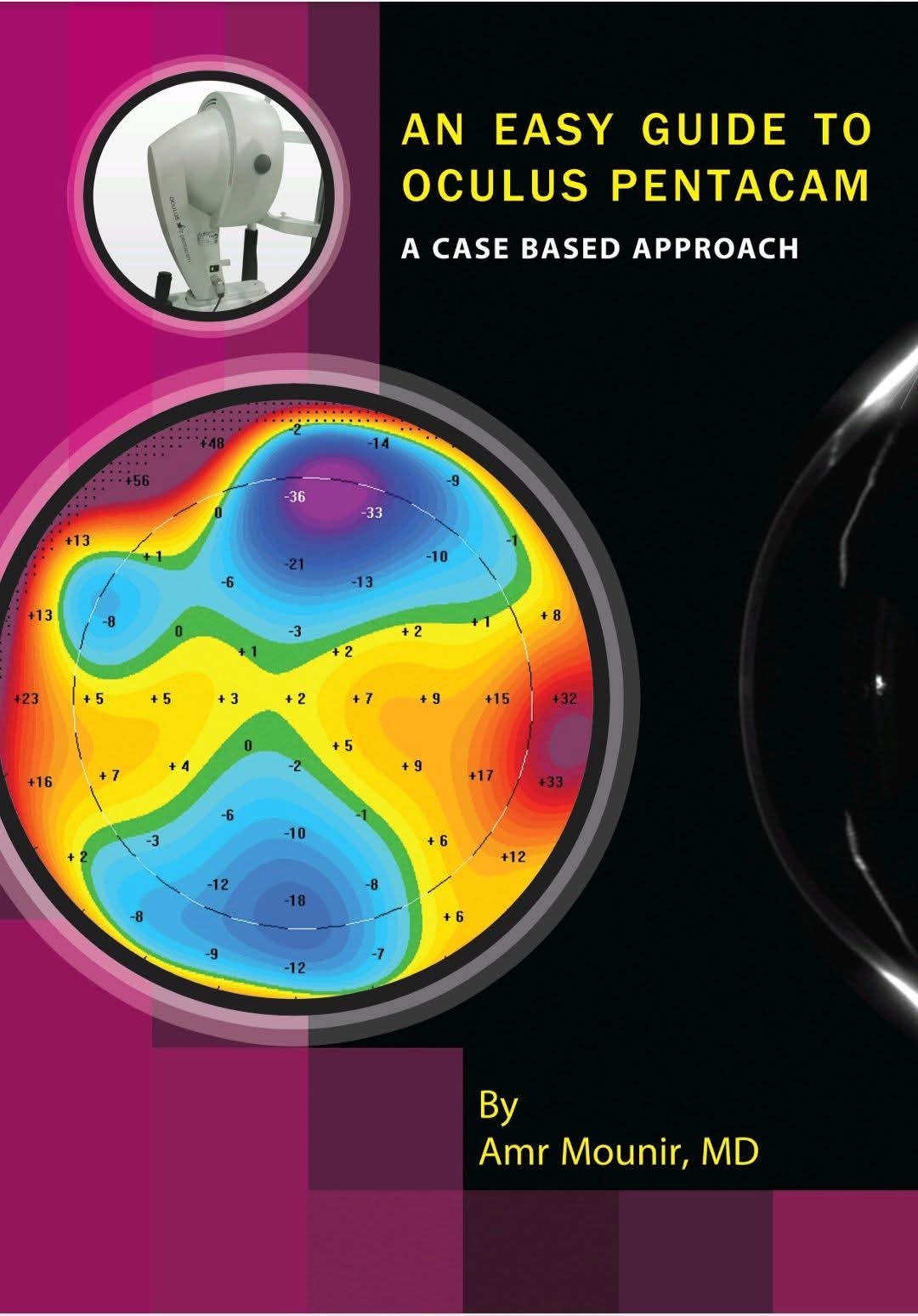 An Easy Guide To Pentacam Corneal Tomography