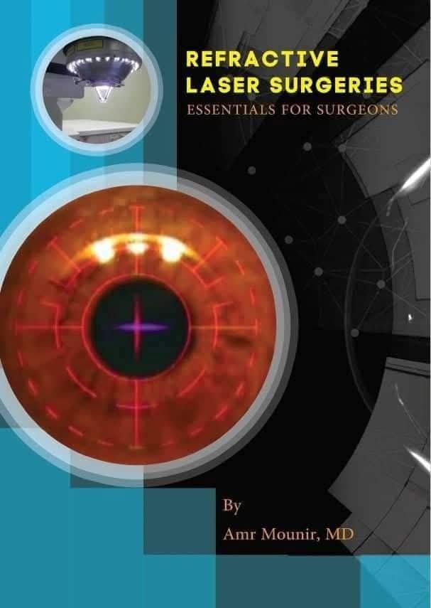 Essentials for Refractive Laser Surgeries
