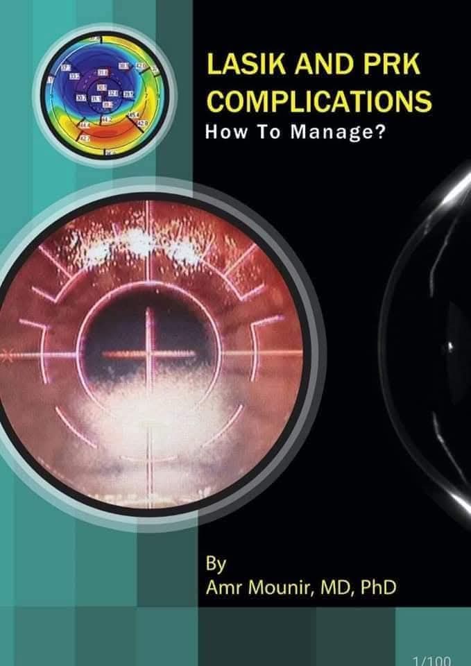 Lasik and PRK Complications